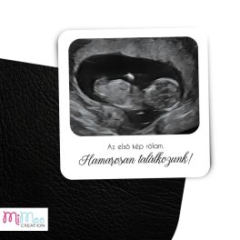   9x9cm-es ajándék kísérő kártya ultrahang fotóval és egyedi szöveggel
