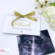 Baba bejelentő kártya – ultrahang fotóval