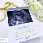 Baba bejelentő kártya – ultrahang fotóval